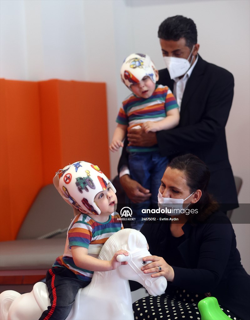 Conjoined twins celebrate their birthday after successful separation |  Anadolu Images