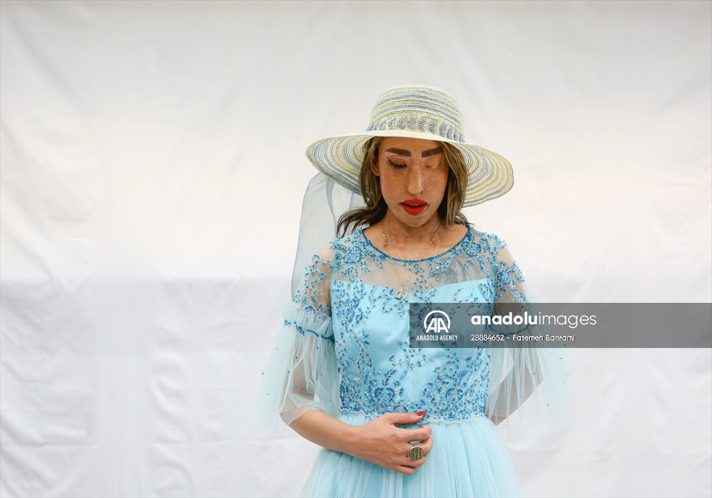 Acid attack victims model for Iranian fashion designer