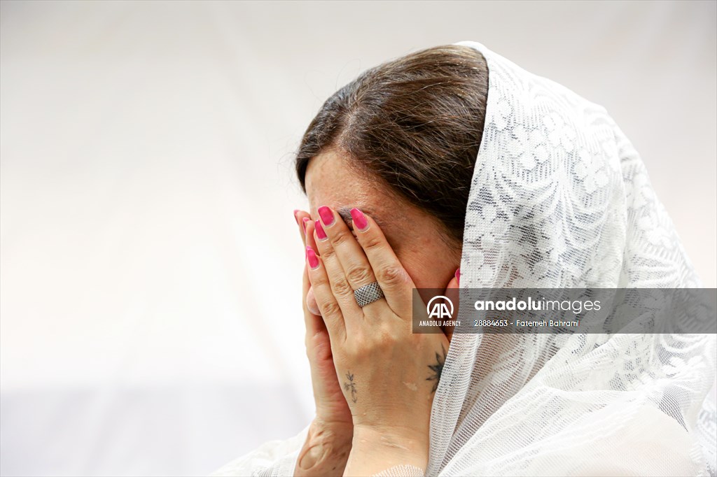 Acid attack victims model for Iranian fashion designer