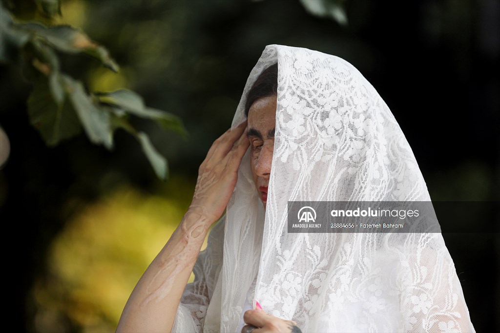 Acid attack victims model for Iranian fashion designer