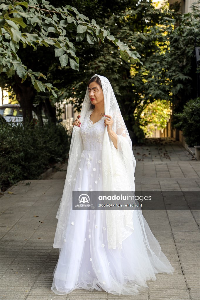 Acid attack victims model for Iranian fashion designer