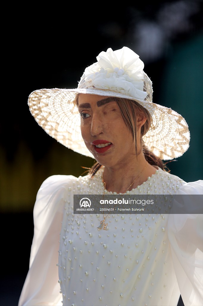 Acid attack victims model for Iranian fashion designer