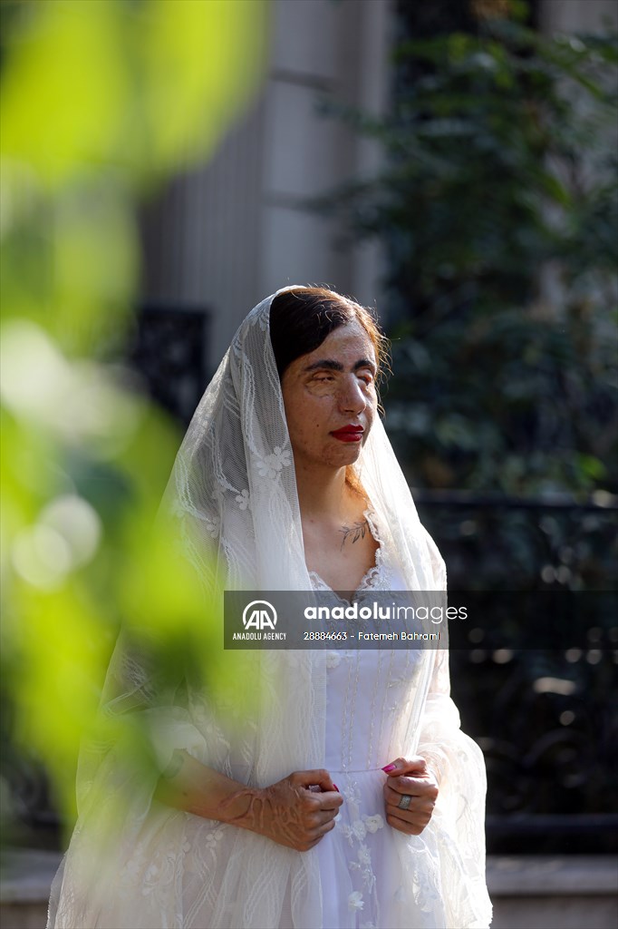 Acid attack victims model for Iranian fashion designer