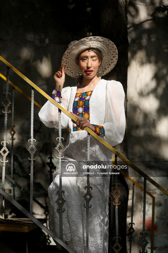 Acid attack victims model for Iranian fashion designer