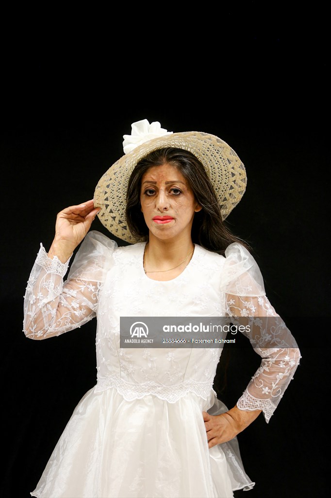 Acid attack victims model for Iranian fashion designer