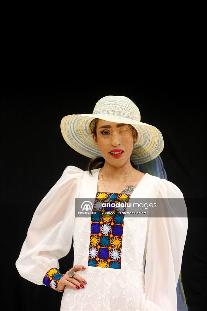 Acid attack victims model for Iranian fashion designer