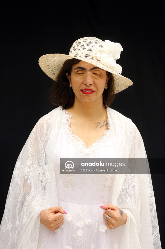 Acid attack victims model for Iranian fashion designer