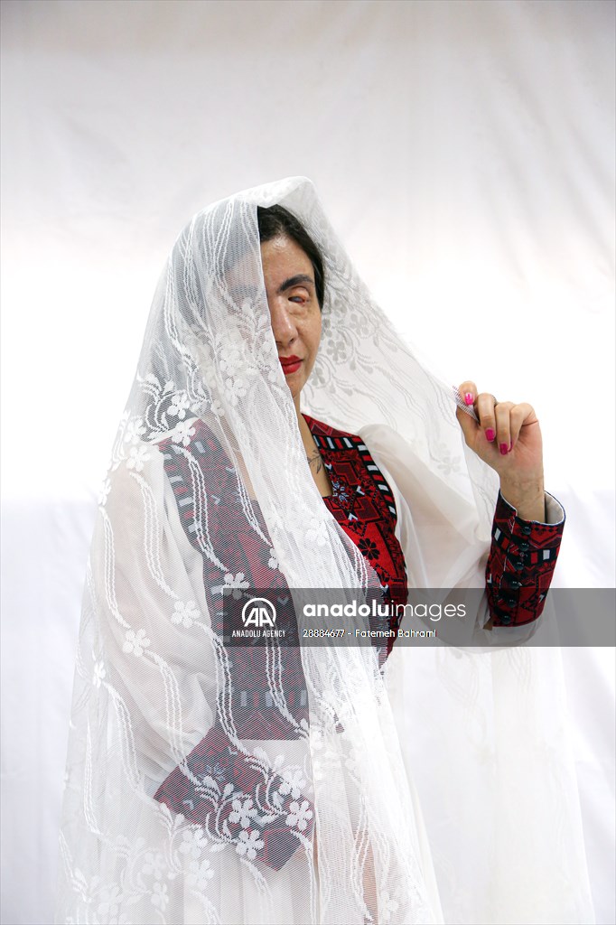 Acid attack victims model for Iranian fashion designer