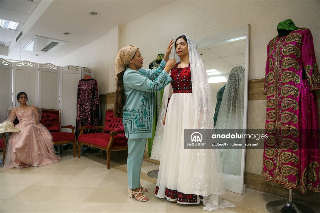 Acid attack victims model for Iranian fashion designer