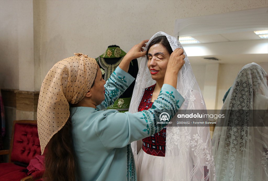 Acid attack victims model for Iranian fashion designer