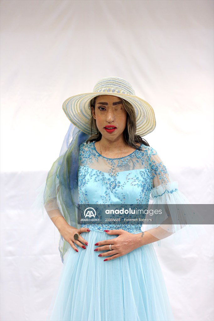 Acid attack victims model for Iranian fashion designer