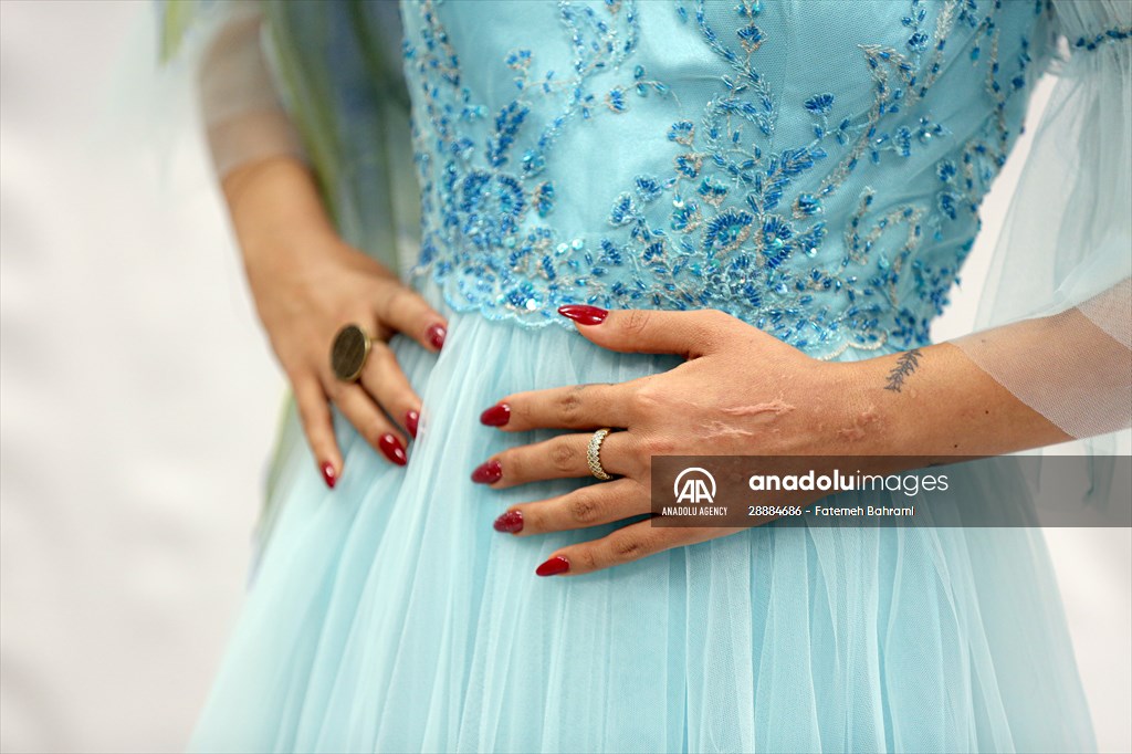 Acid attack victims model for Iranian fashion designer