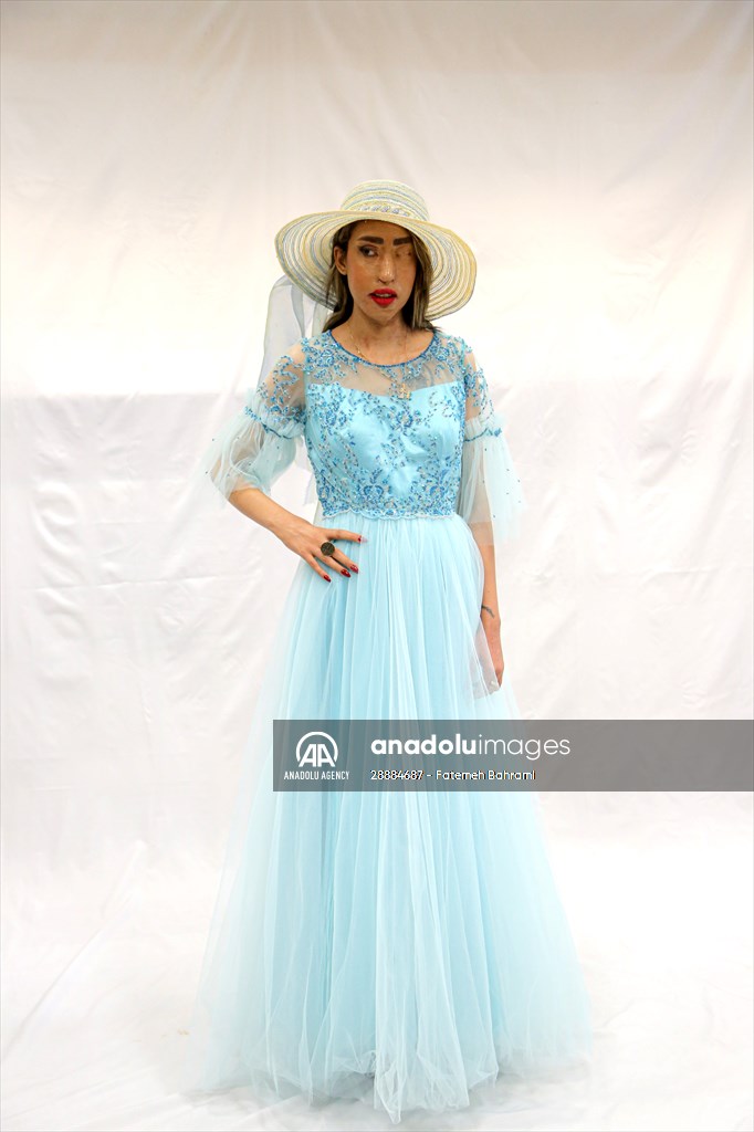 Acid attack victims model for Iranian fashion designer