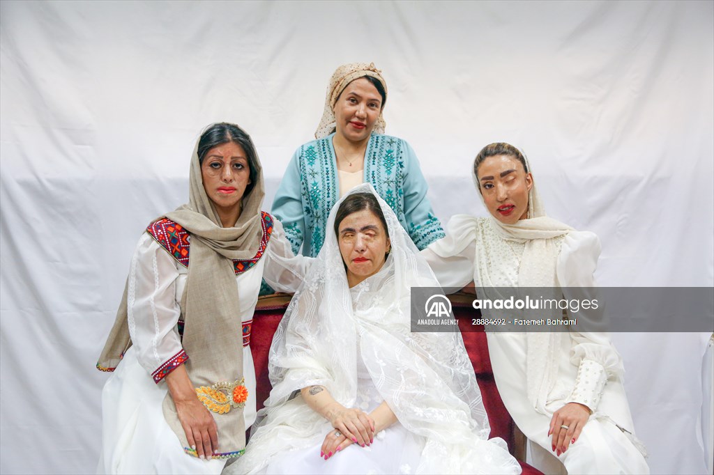Acid attack victims model for Iranian fashion designer