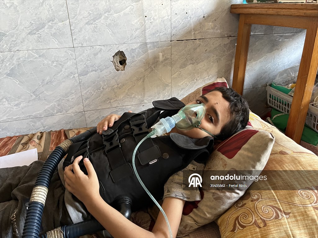 Karaciğer sirozu olan Filistinli çocuk İsrail ambargosu nedeniyle tedaviden mahrum