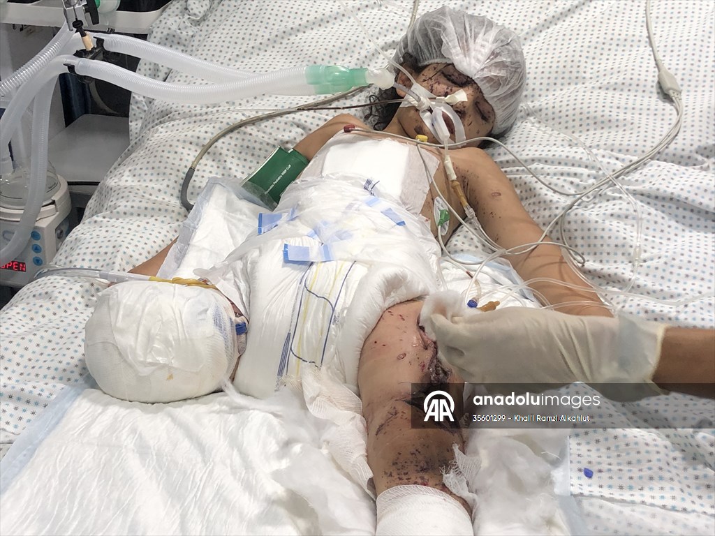 Palestinian girl struggles to survive all alone