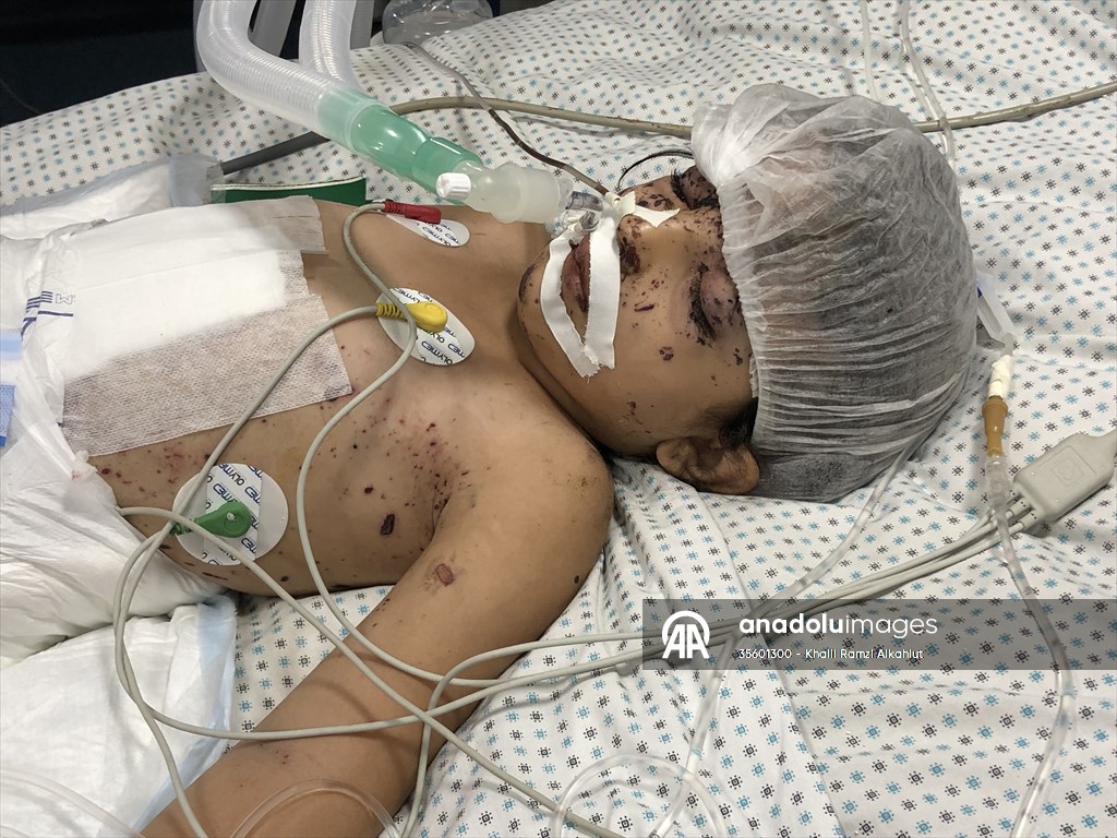 Palestinian girl struggles to survive all alone