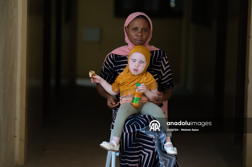 Albino children in Zanzibar