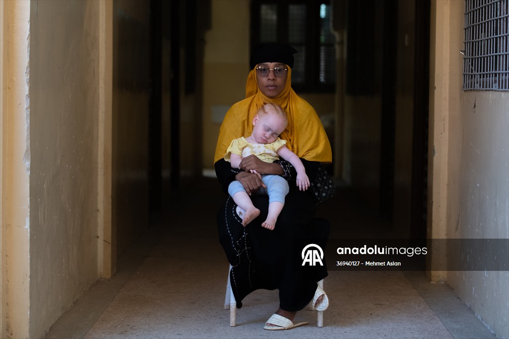 Albino children in Zanzibar