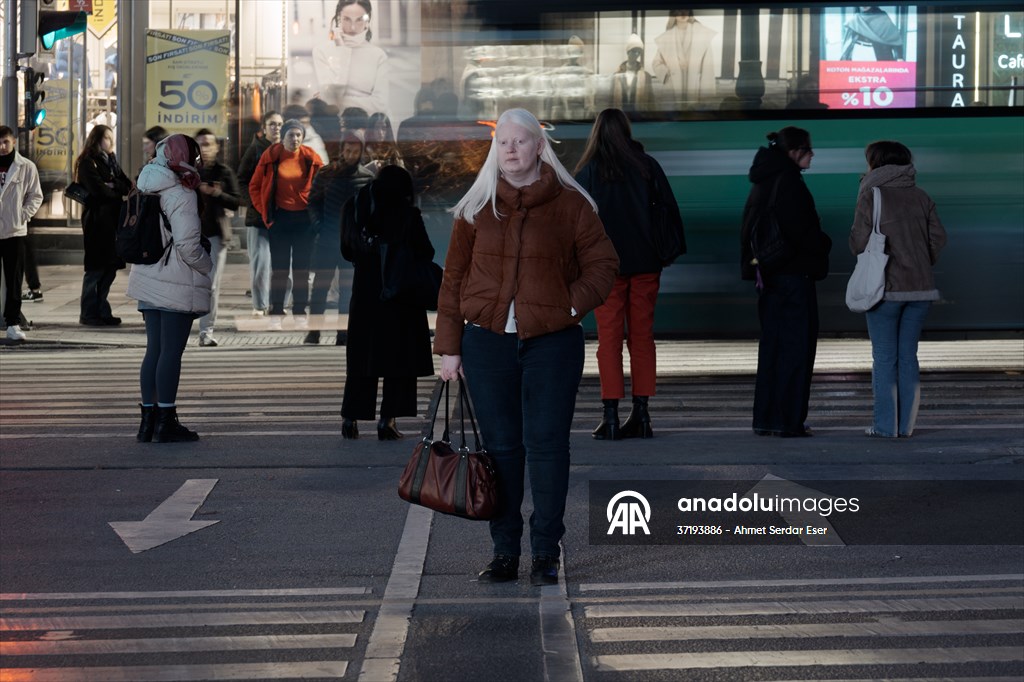 Dünya Nadir Hastalıklar Günü: 'Albino olmak'