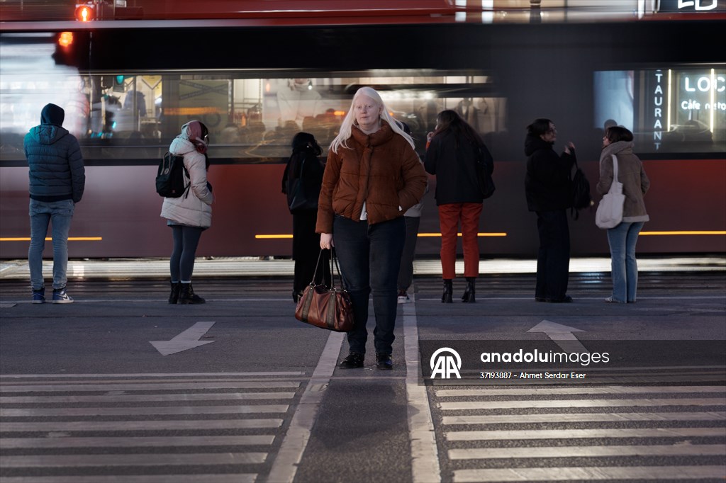 Dünya Nadir Hastalıklar Günü: 'Albino olmak'