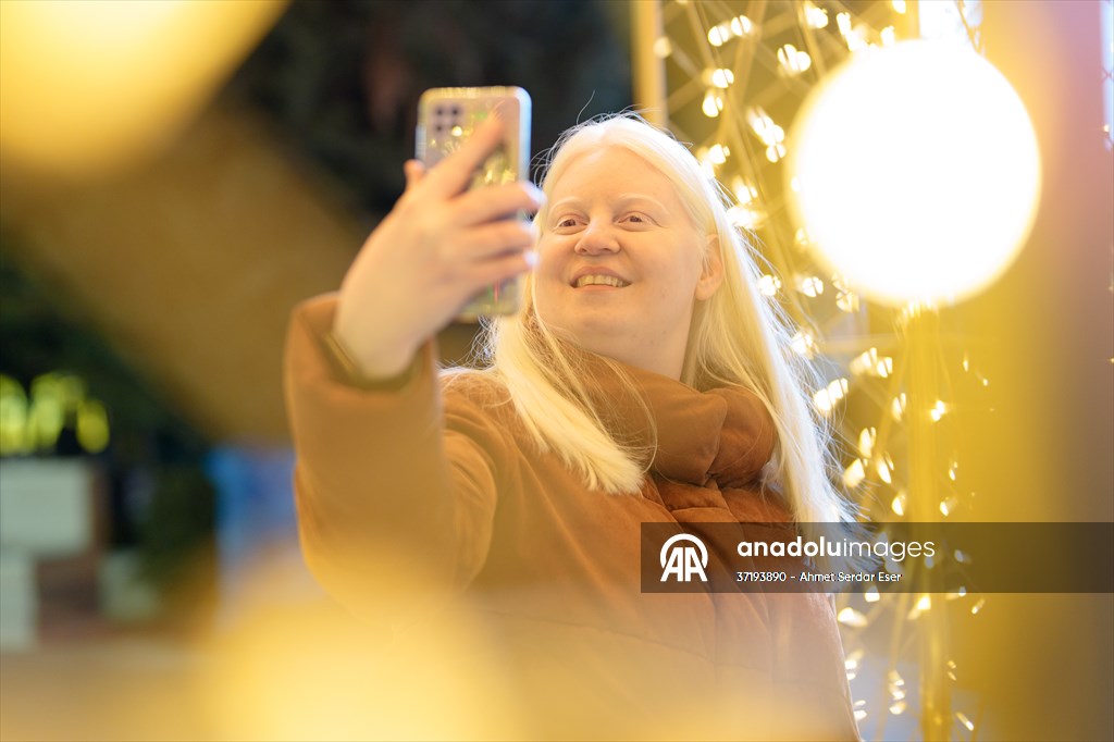 Dünya Nadir Hastalıklar Günü: 'Albino olmak'