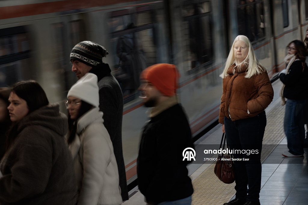Dünya Nadir Hastalıklar Günü: 'Albino olmak'