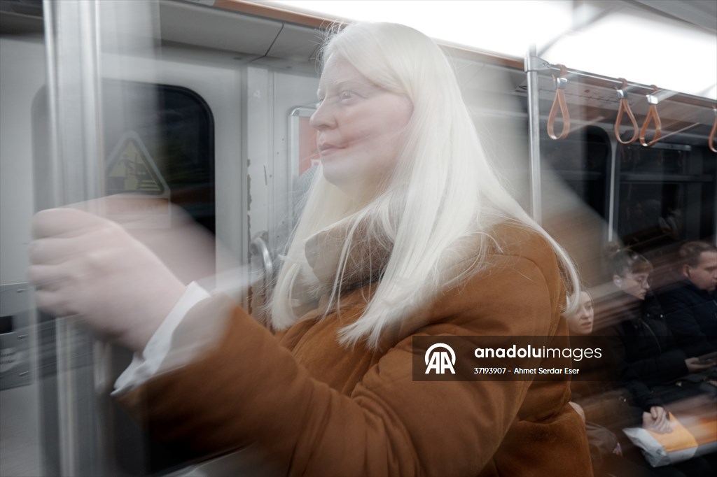 Dünya Nadir Hastalıklar Günü: 'Albino olmak'