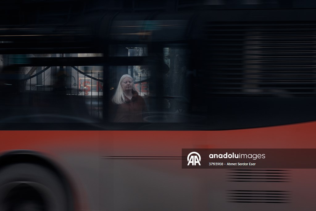 Dünya Nadir Hastalıklar Günü: 'Albino olmak'