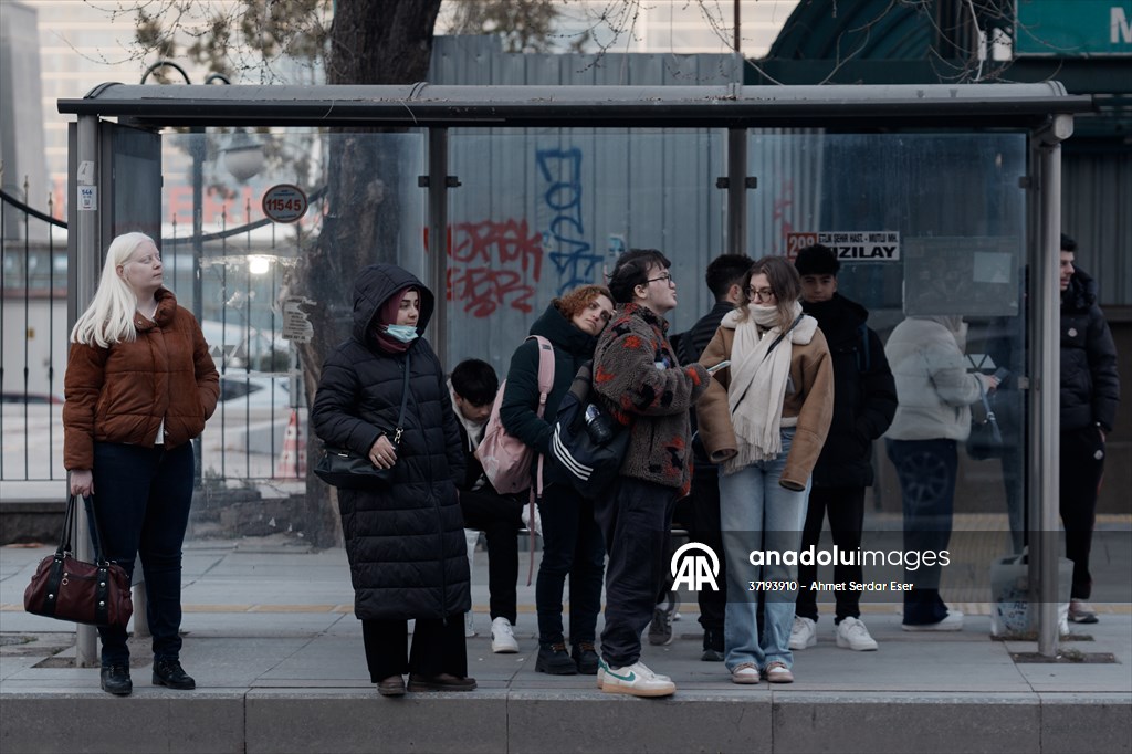 Dünya Nadir Hastalıklar Günü: 'Albino olmak'