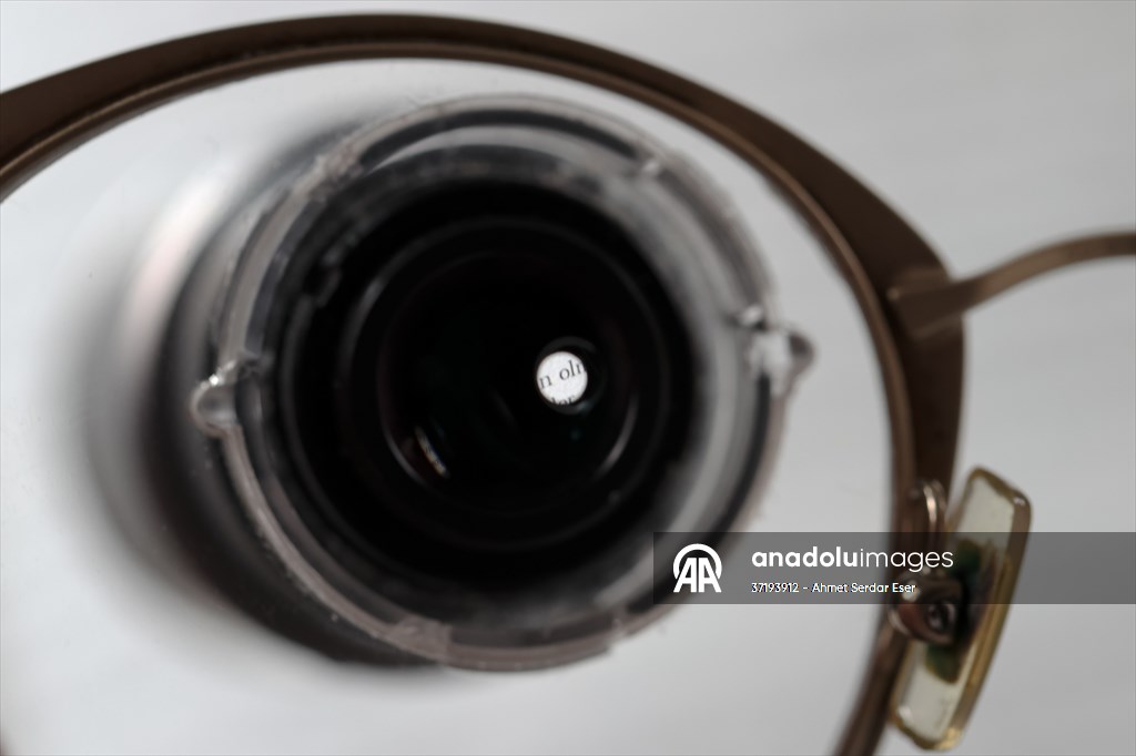 Dünya Nadir Hastalıklar Günü: 'Albino olmak'