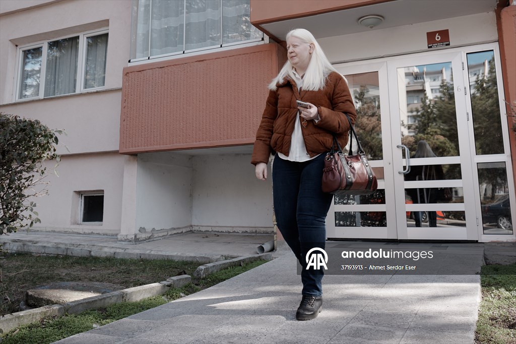 Dünya Nadir Hastalıklar Günü: 'Albino olmak'