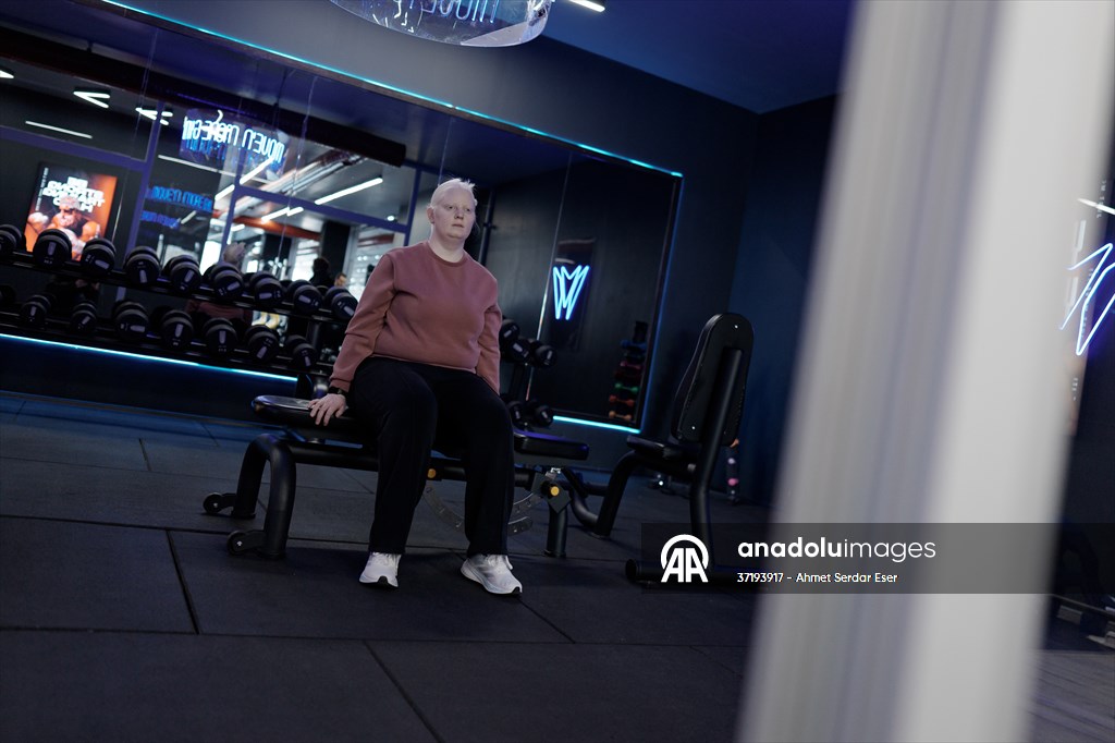 Dünya Nadir Hastalıklar Günü: 'Albino olmak'