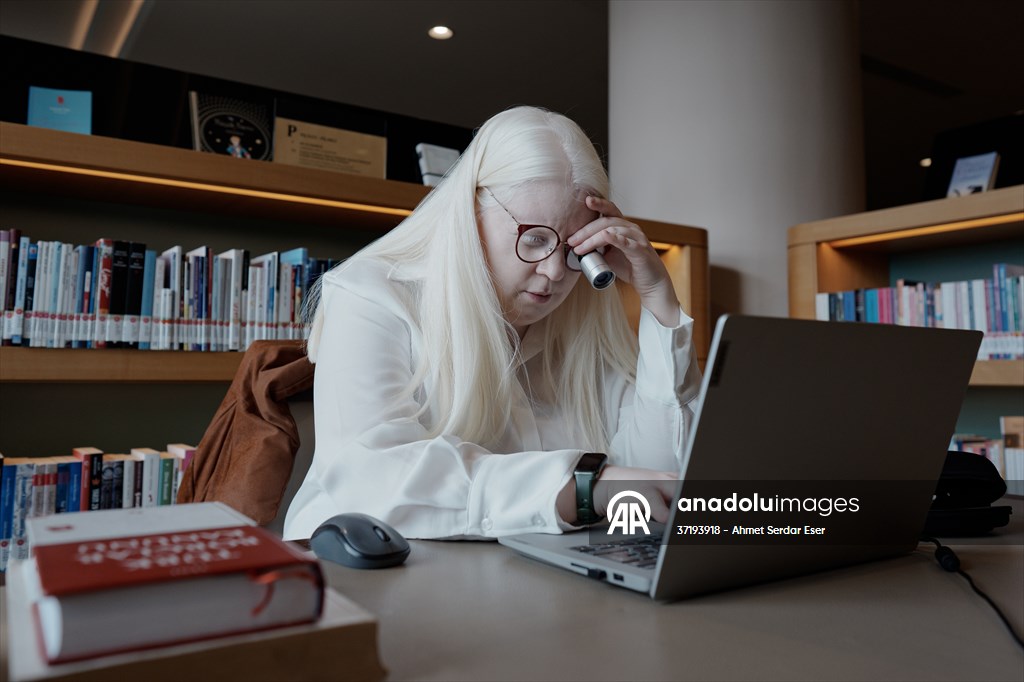 Dünya Nadir Hastalıklar Günü: 'Albino olmak'