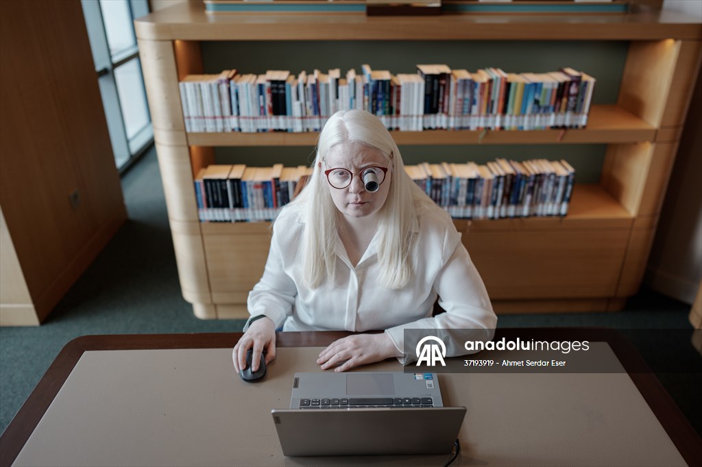 Dünya Nadir Hastalıklar Günü: 'Albino olmak'