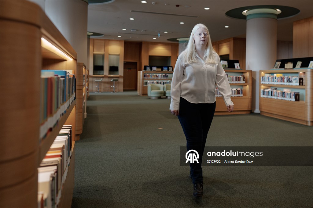 Dünya Nadir Hastalıklar Günü: 'Albino olmak'