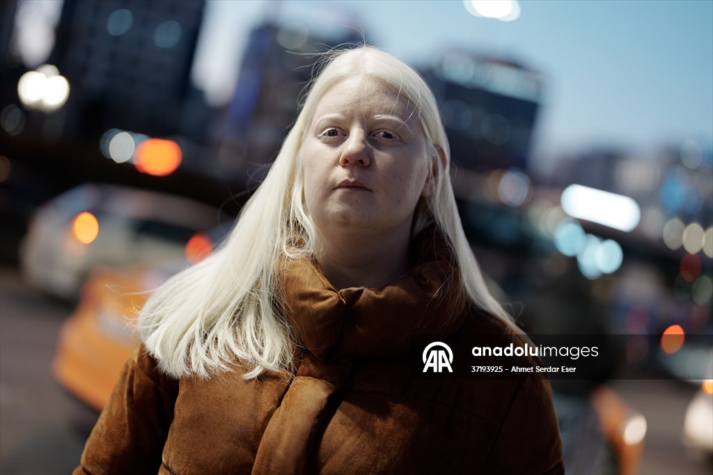 Dünya Nadir Hastalıklar Günü: 'Albino olmak'