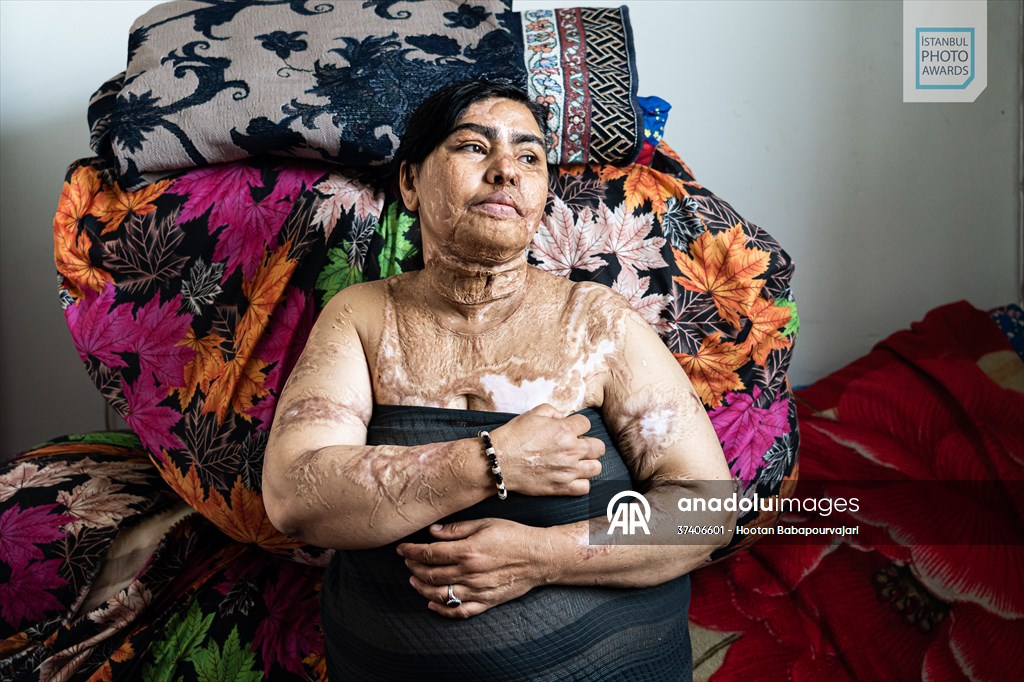 Winners of Istanbul Photo Awards 2025 announced