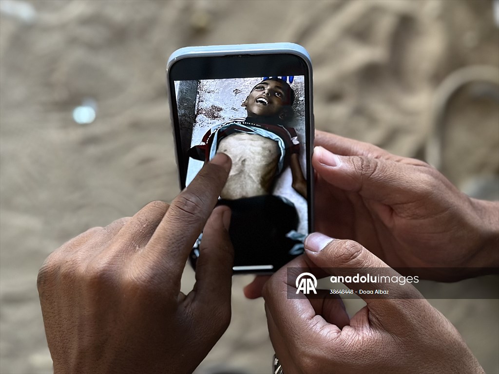 Gazze’de açlıkla mücadele eden AA serbest habercileri insani krizi aktarmayı sürdürüyor