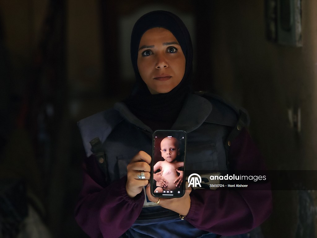 Gazze’de açlıkla mücadele eden AA serbest habercileri insani krizi aktarmayı sürdürüyor