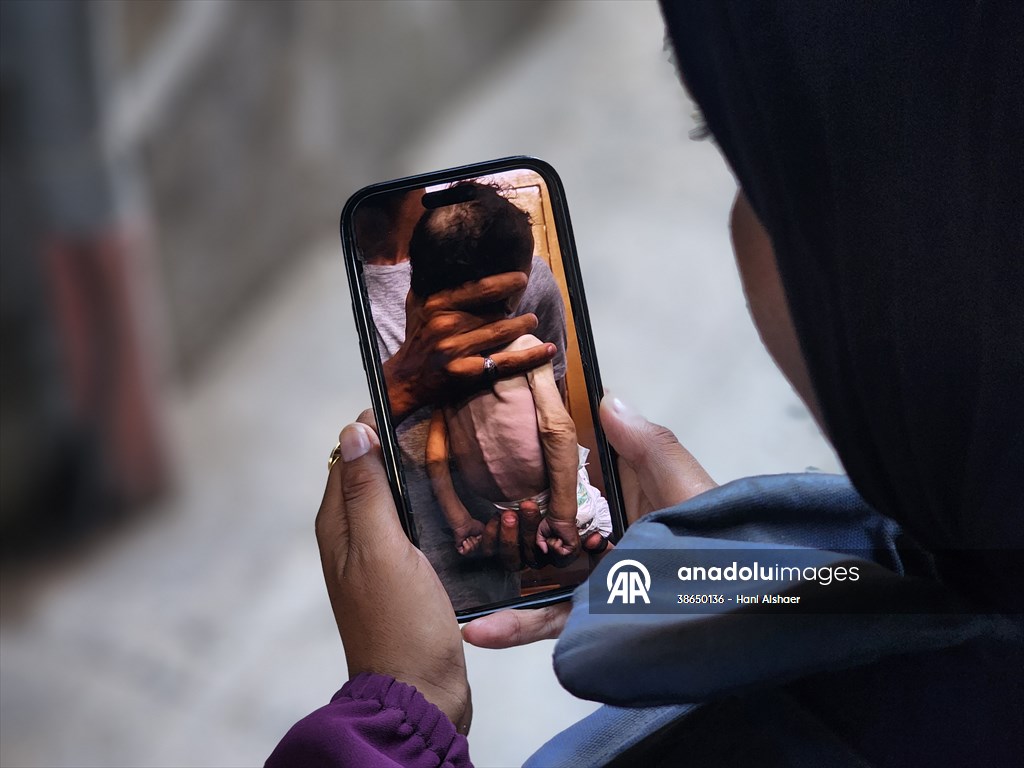 Gazze’de açlıkla mücadele eden AA serbest habercileri insani krizi aktarmayı sürdürüyor