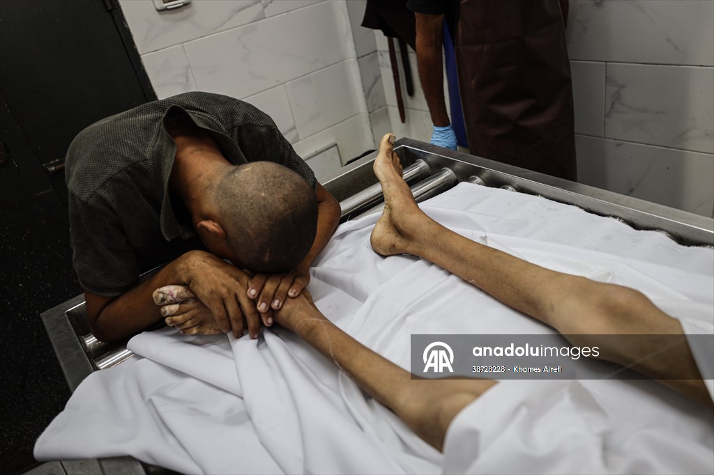 17-year-old boy dies in Gaza due to malnutrition