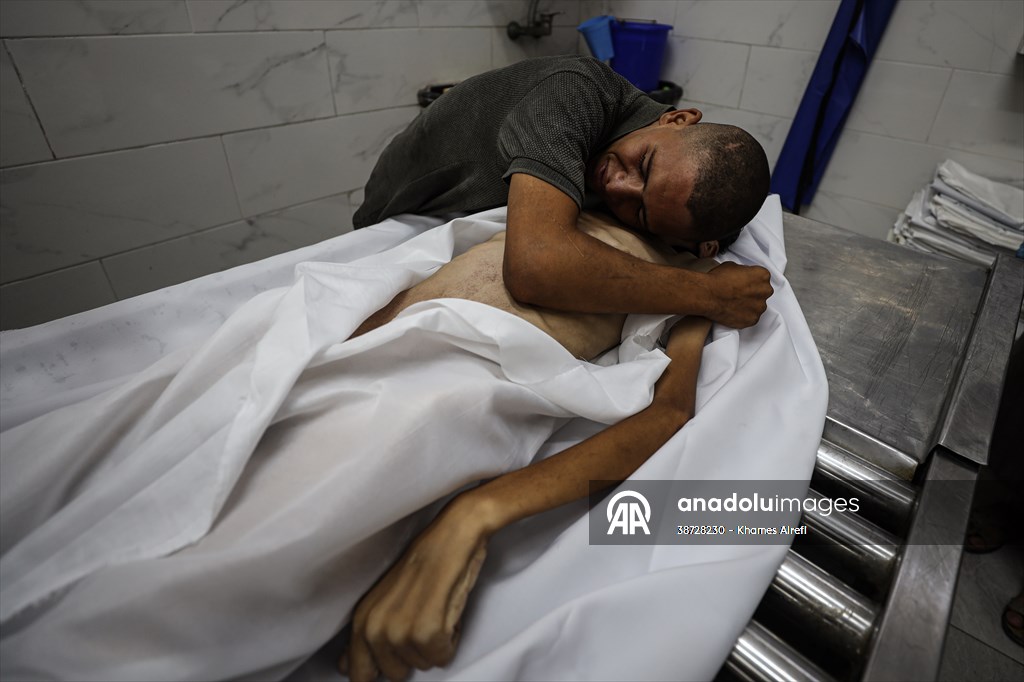 17-year-old boy dies in Gaza due to malnutrition