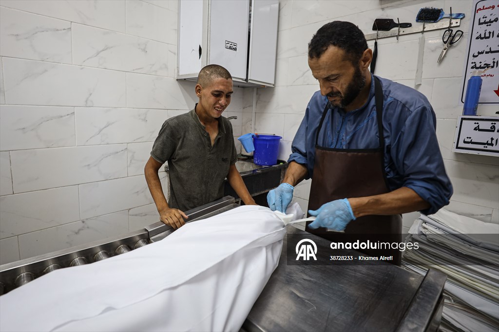 17-year-old boy dies in Gaza due to malnutrition