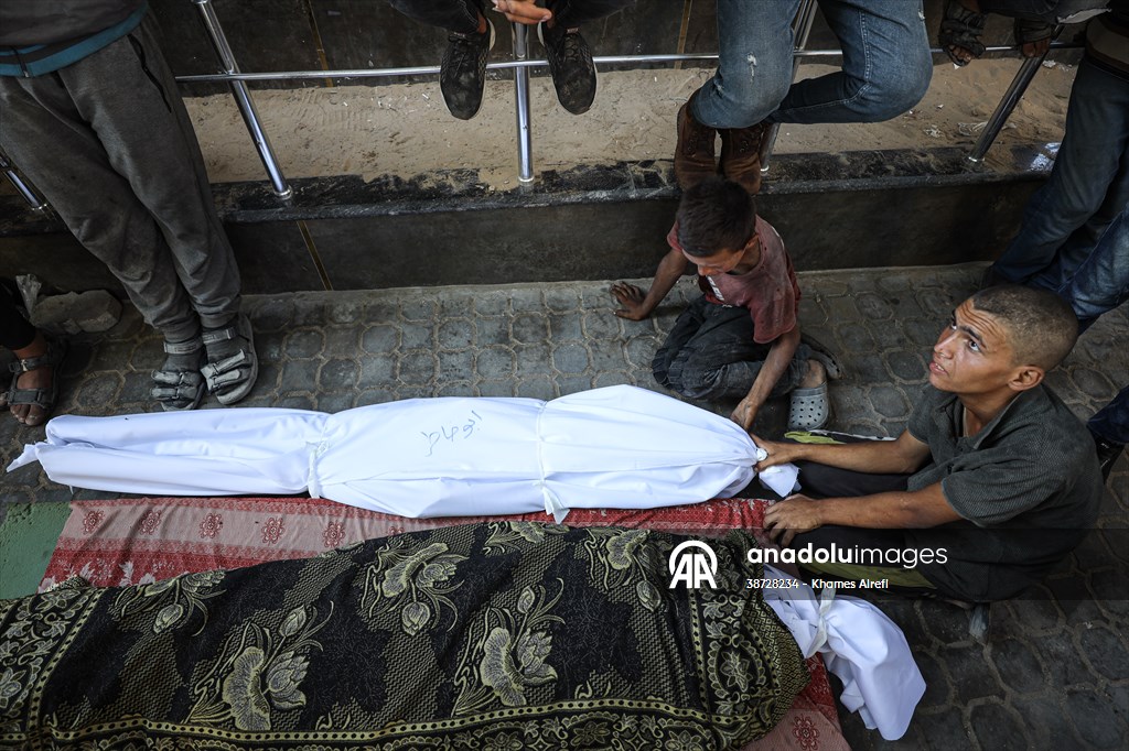 17-year-old boy dies in Gaza due to malnutrition