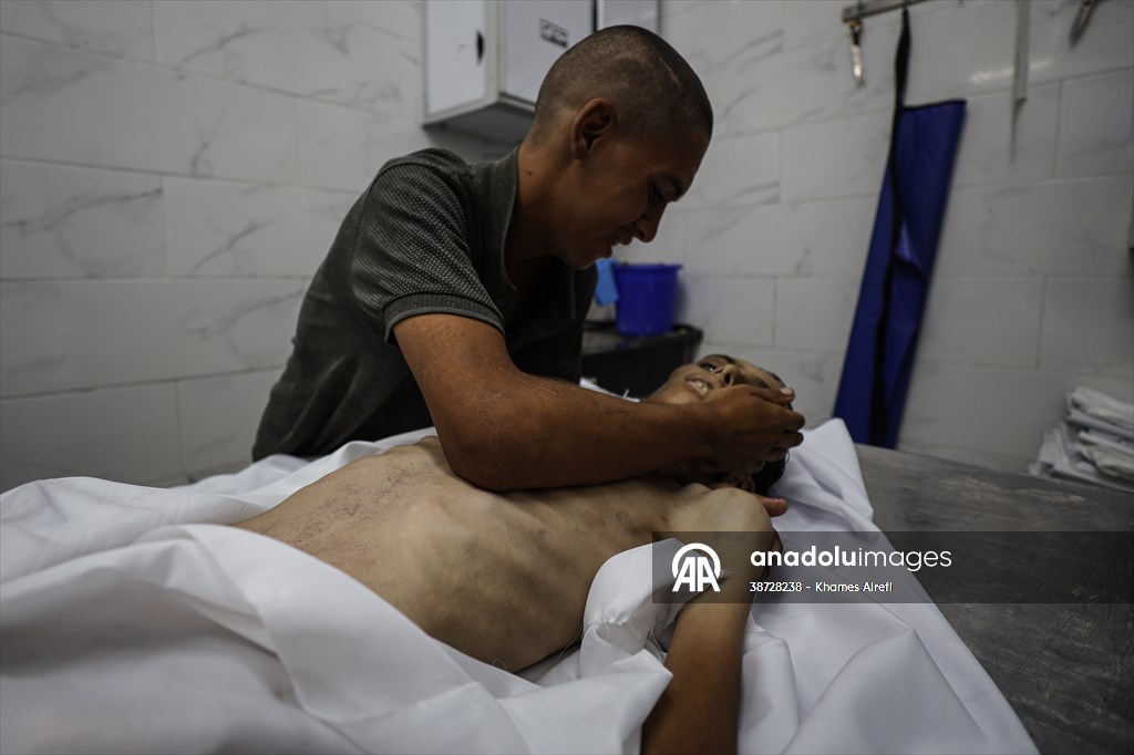 17-year-old boy dies in Gaza due to malnutrition