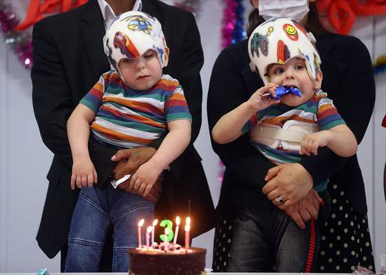 Conjoined twins celebrate their birthday after successful separation