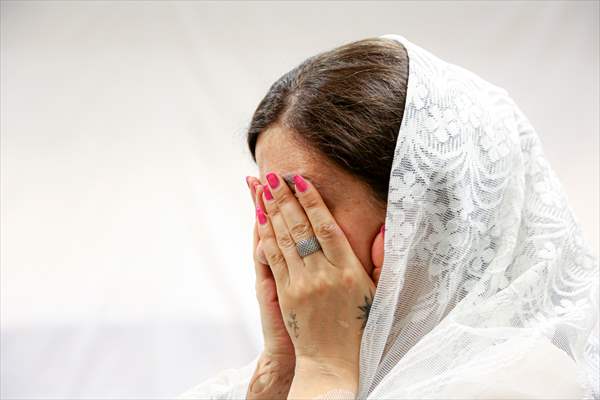 Acid attack victims model for Iranian fashion designer