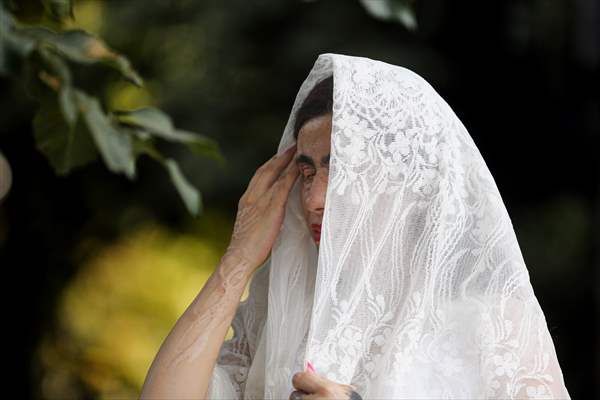 Acid attack victims model for Iranian fashion designer
