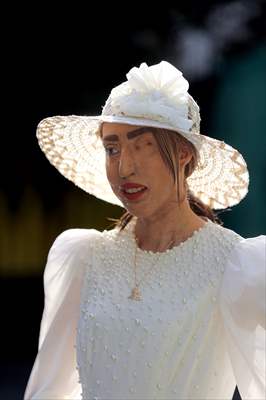 Acid attack victims model for Iranian fashion designer